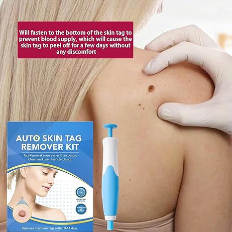 ✨ Acrochordon Skin Tag Remover Kit – 2-in-1 Fast & Painless Solution 🩹💖